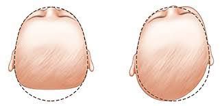 voorkeurshouding afplatting.jpg